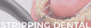 Lee más sobre el artículo ¿Para qué sirve el stripping dental?