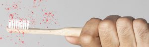 Lee más sobre el artículo Tus encías te avisan: Síntomas de la periodontitis