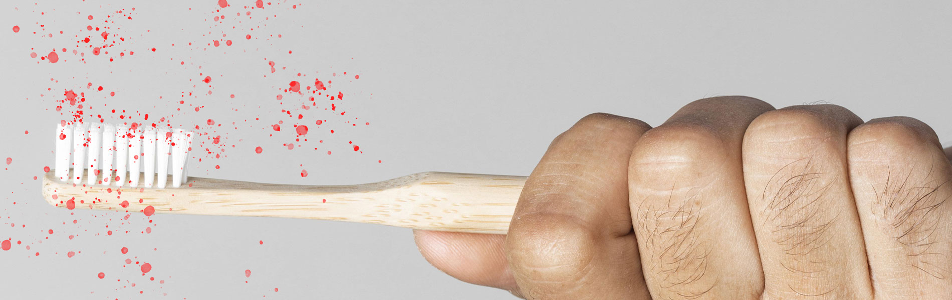 En este momento estás viendo Tus encías te avisan: Síntomas de la periodontitis