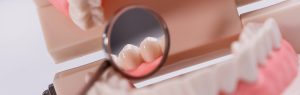 Lee más sobre el artículo Amalgama dental: Qué es y riesgos