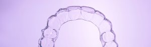 Lee más sobre el artículo Diferencias entre brackets y alineadores transparentes