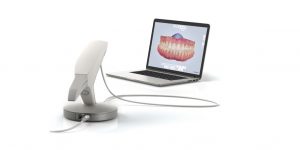 Lee más sobre el artículo Así funciona una impresión dental digital.
