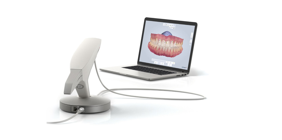 En este momento estás viendo Así funciona una impresión dental digital.