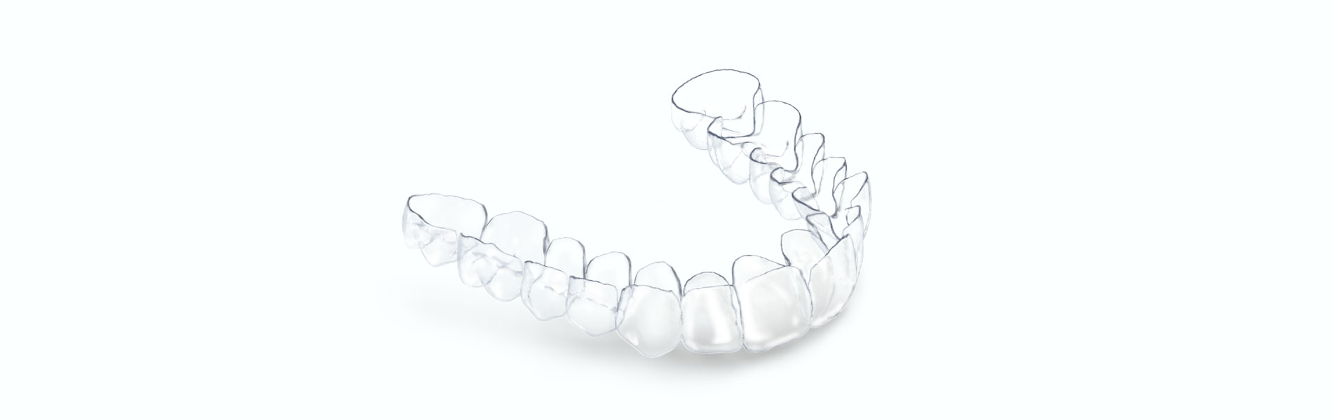 En este momento estás viendo <strong>Cuánto tiempo dura un tratamiento con alineadores dentales</strong>
