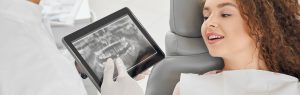 Lee más sobre el artículo <strong>Radiografias intraorales: Tipos y para qué se utilizan</strong>