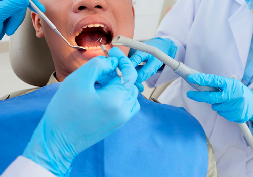 En este momento estás viendo ¿Cuál es la diferencia entre un empaste y una endodoncia?