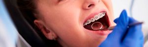 Lee más sobre el artículo ¿Por qué se mueven los dientes después de una ortodoncia?