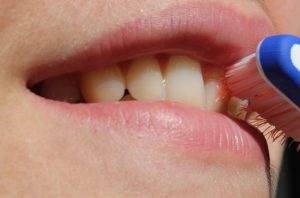 Lee más sobre el artículo Gingivitis avanzada: síntomas y tratamientos efectivos