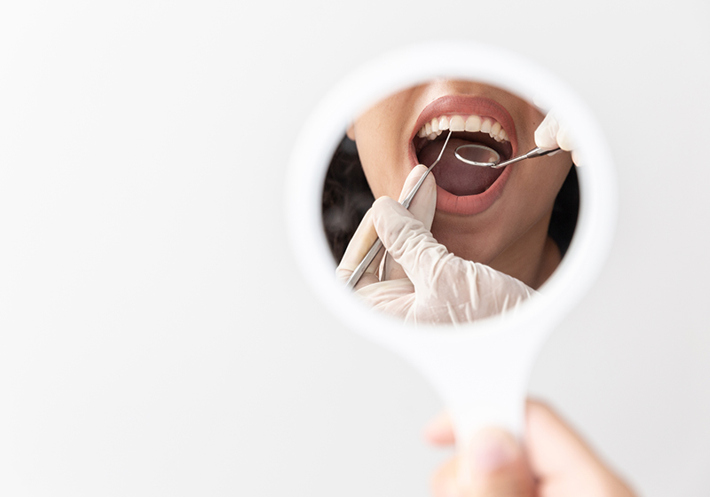 En este momento estás viendo ¿Cuánto dura una limpieza dental?